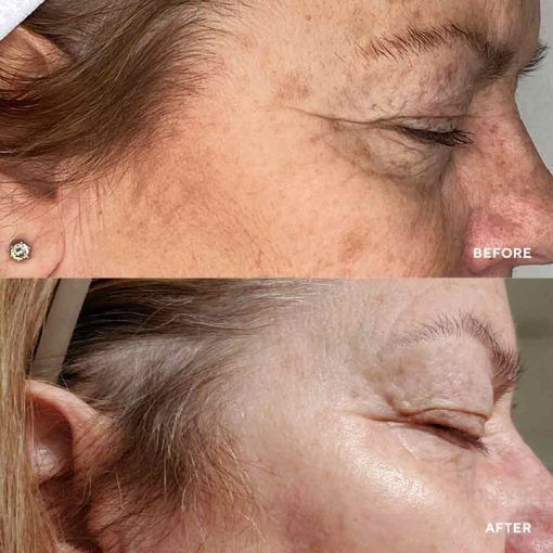 HydroPeptide Vital Eyes &ndash; Cироватка з миттєвою антивіковою дією HP022 фото