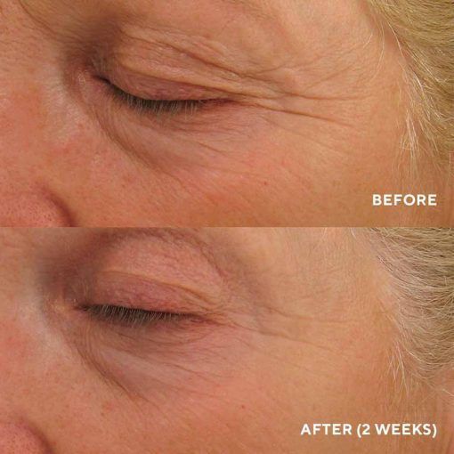 HydroPeptide Eye Authority &ndash; Інтенсивний ліфтинг-крем для повік HP035 фото